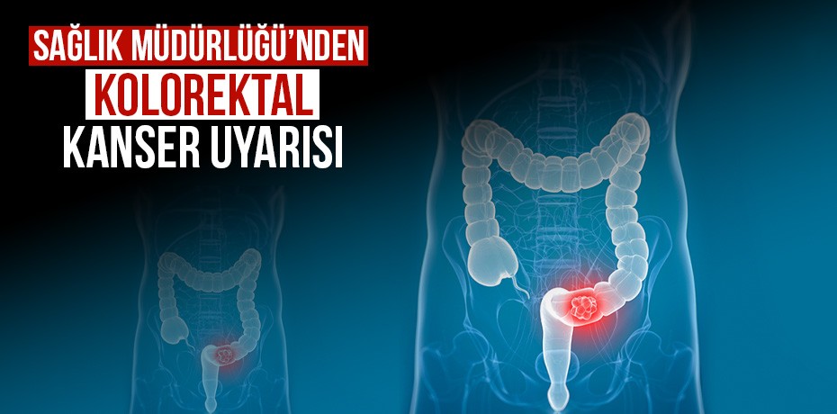 Sağlık Müdürlüğü'nden kolorektal kanser uyarısı